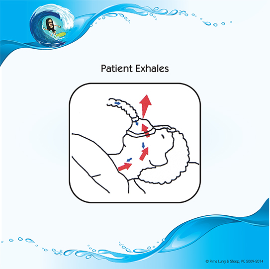 Patient exhales