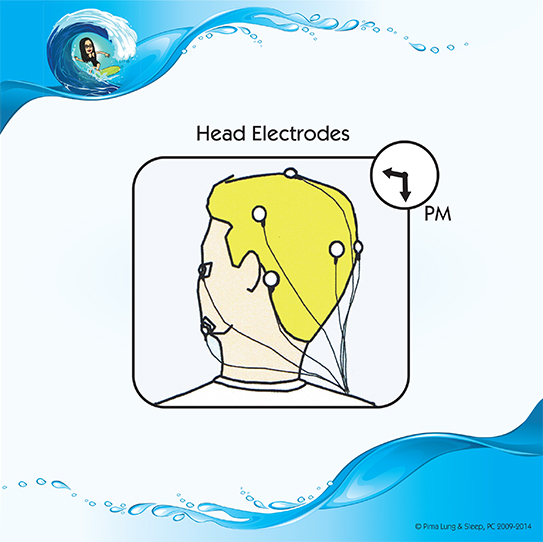 Head Electrodes